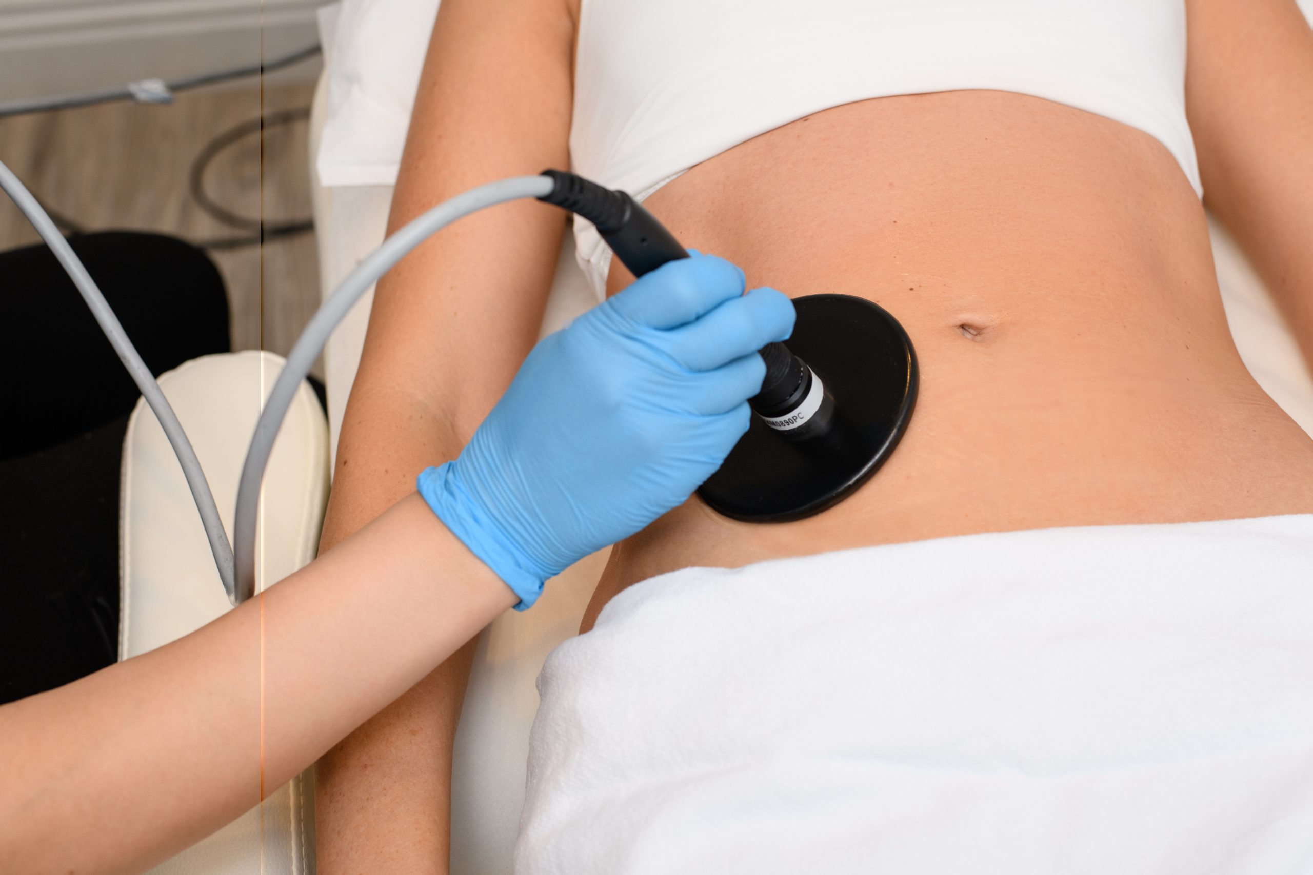 Body contouring treatment at Nathan Newman MD